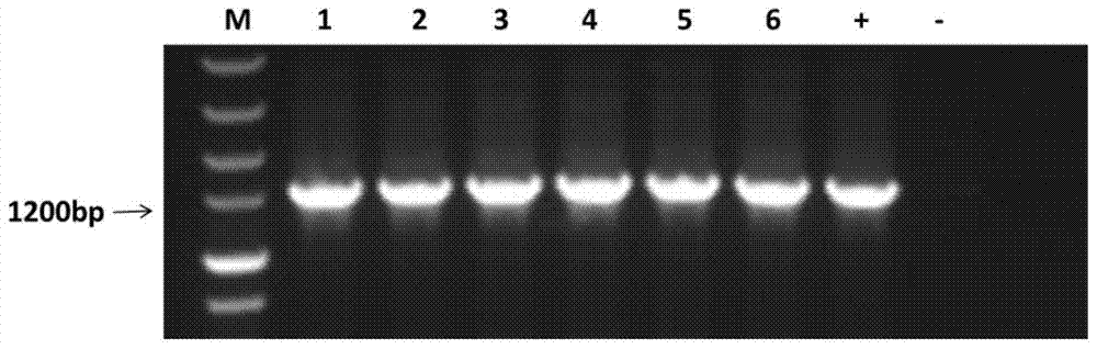 A promoter regulating gene expression in non-secreting glandular trichomes and its application