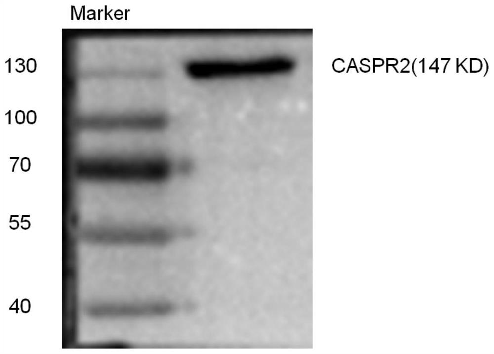 Detection material, preparation method and application of anti-caspr2 autoantibody in human body fluid