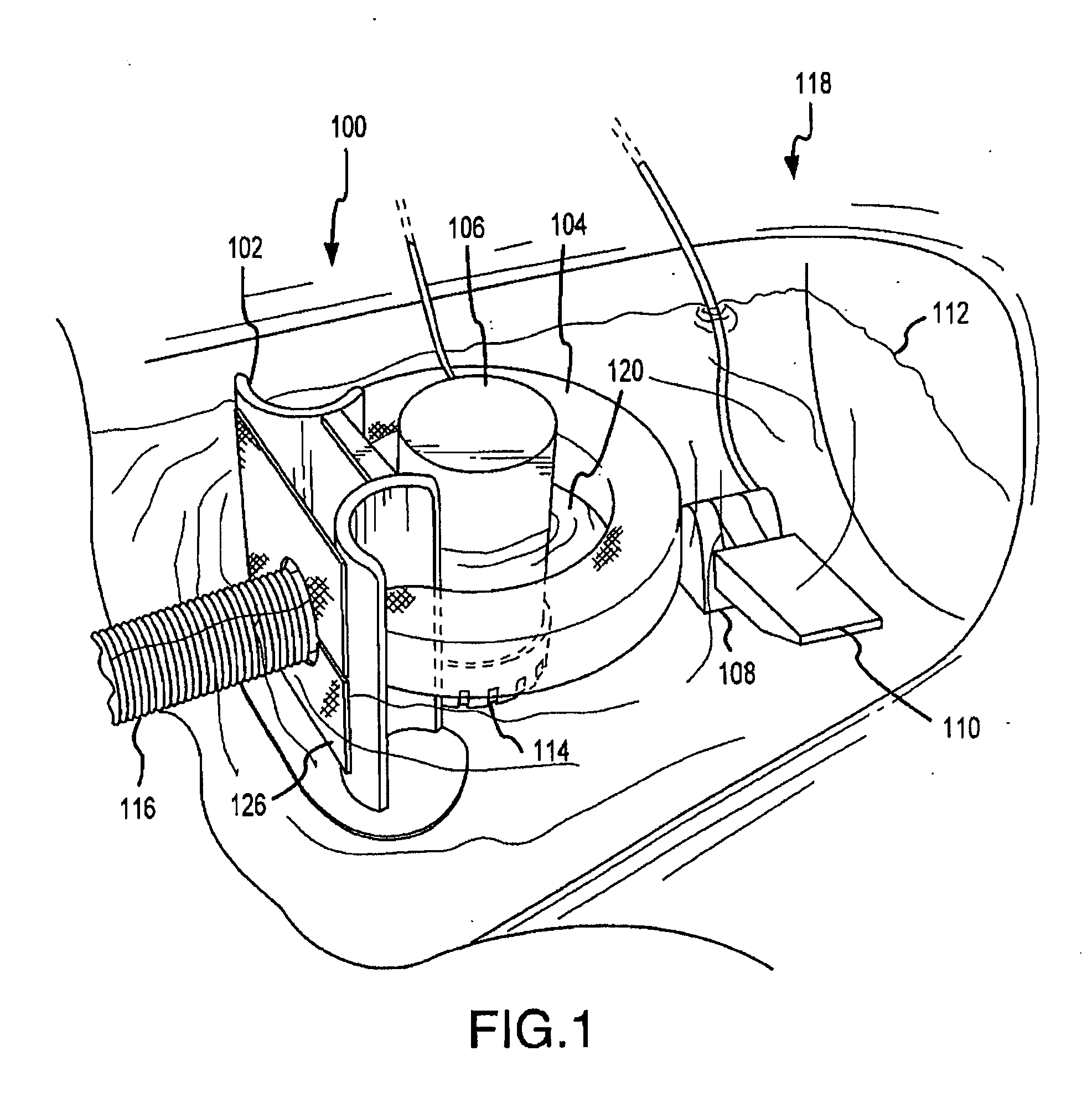 Water pollution prevention and remediation apparatus