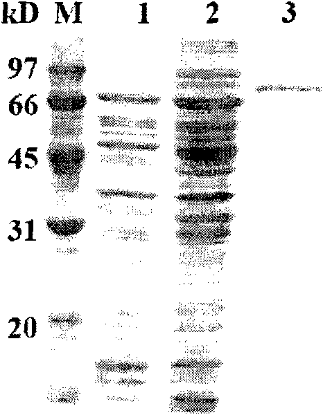 Novel antiprotease acid alpha-galactosidase AGA36 and gene and application thereof