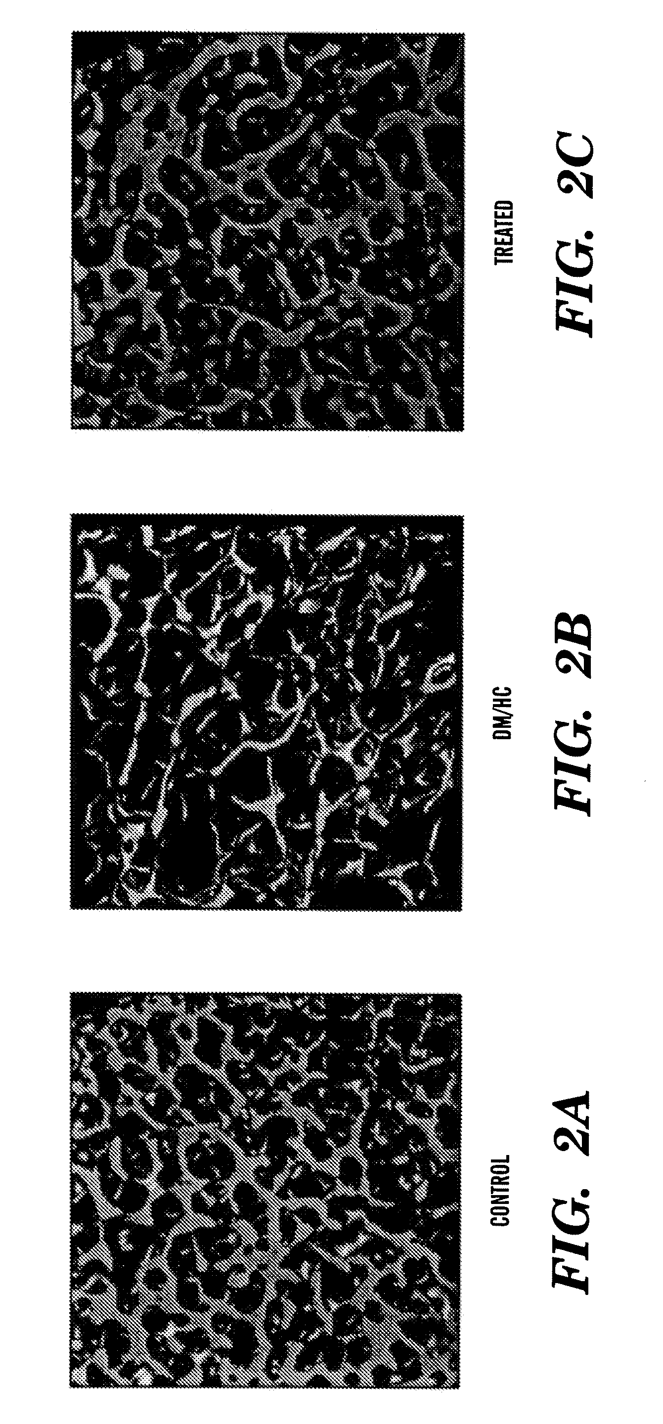 Methods of treatment and prevention of metabolic bone diseases and disorders