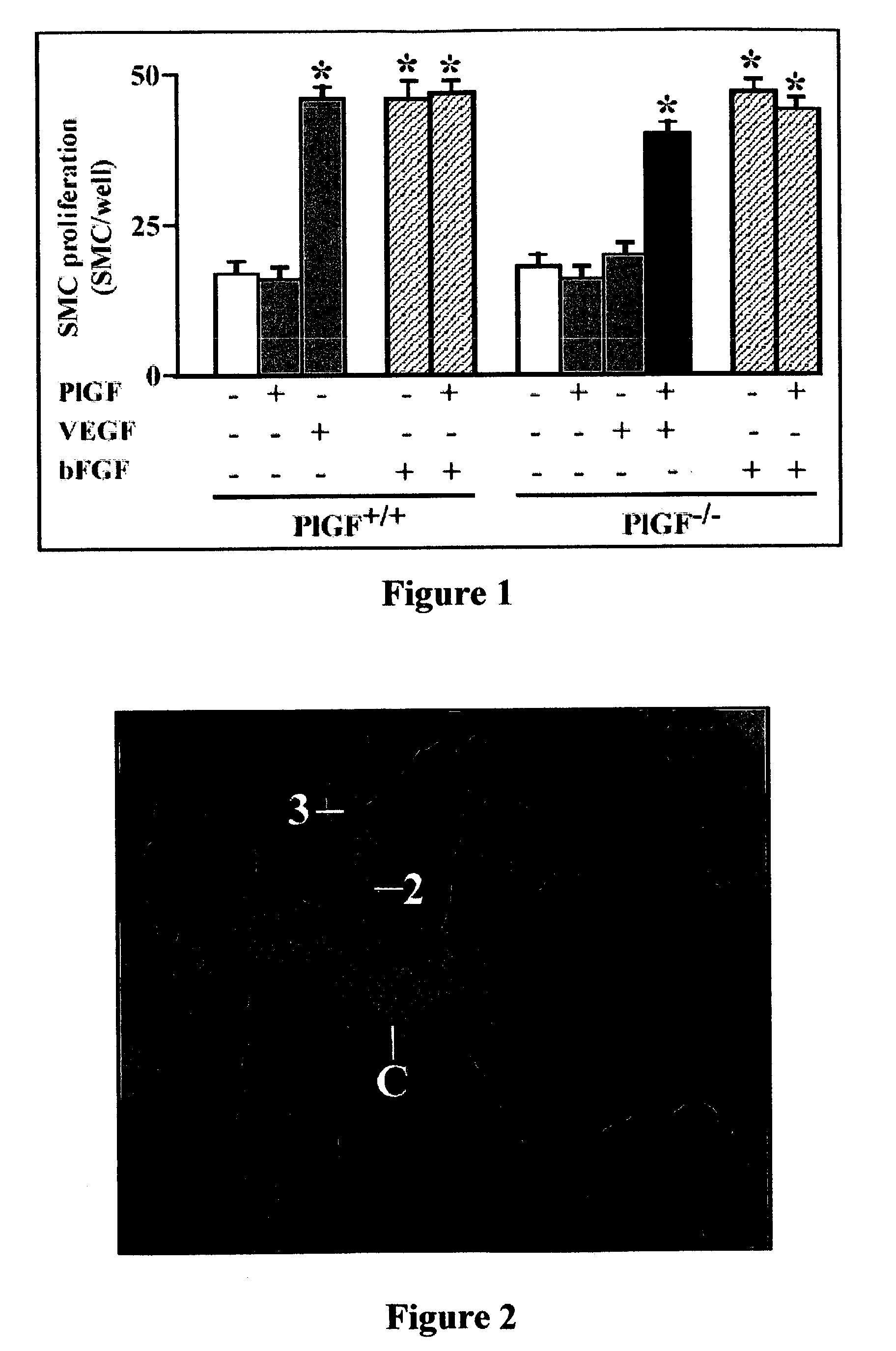 Method of improving ischemic muscle function by administering placental growth factor