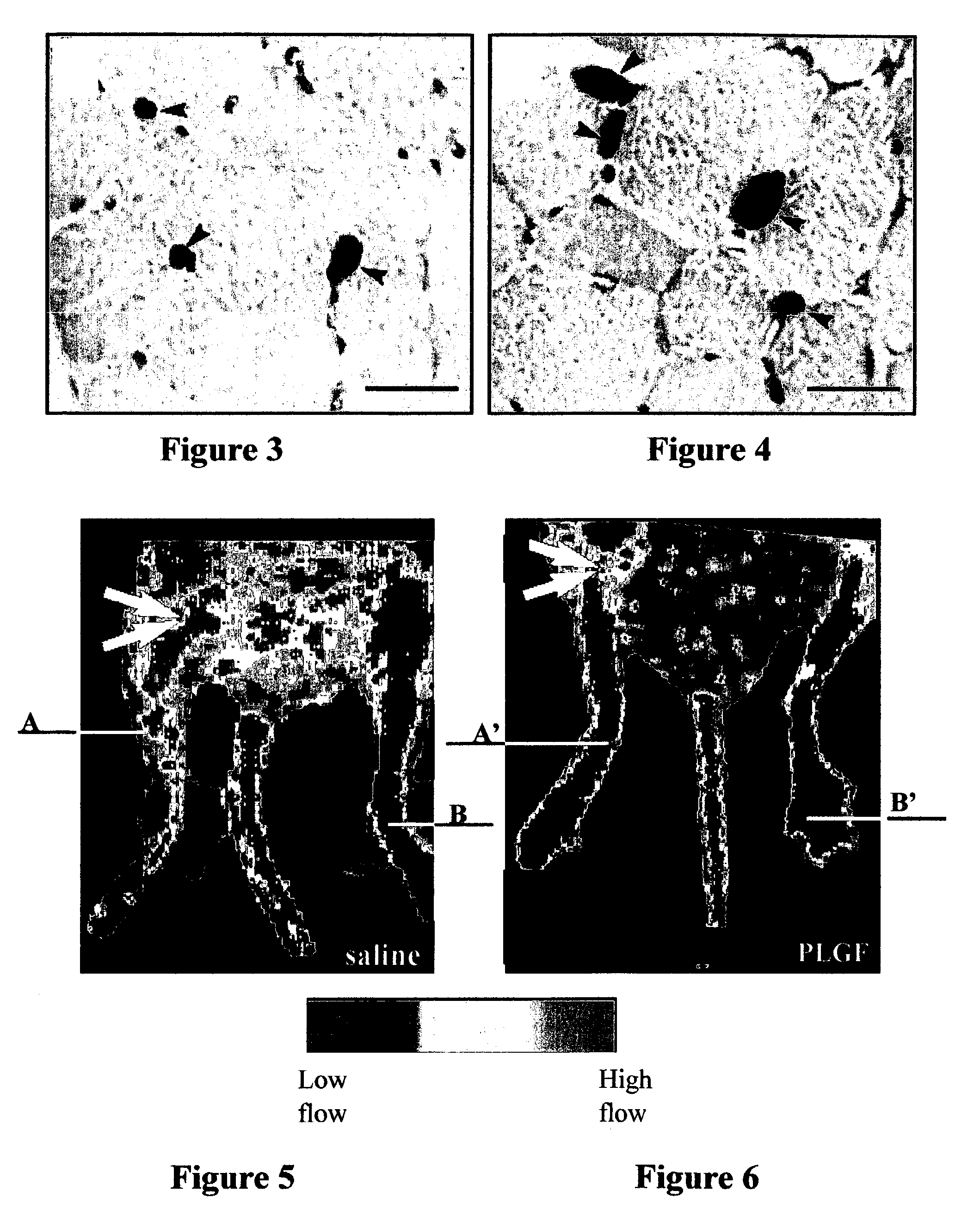 Method of improving ischemic muscle function by administering placental growth factor
