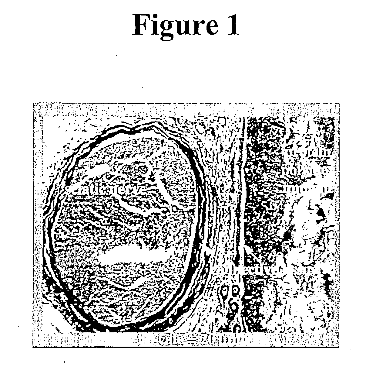Biomatrix structural containment and fixation systems and methods of use thereof