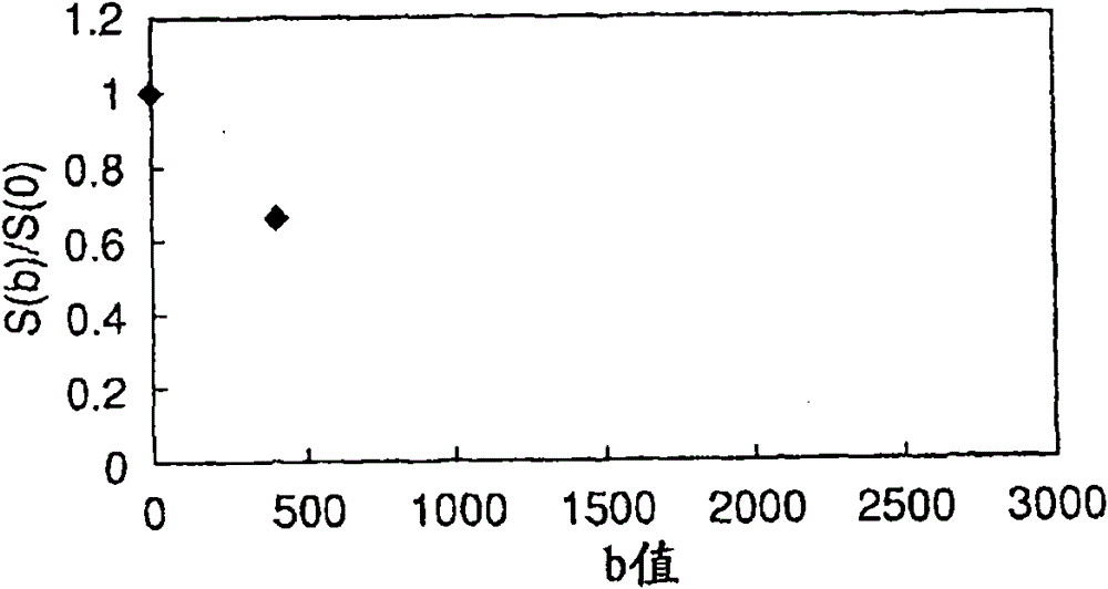 Magnetic resonance diagnostic apparatus and magnetic resonance diagnostic method