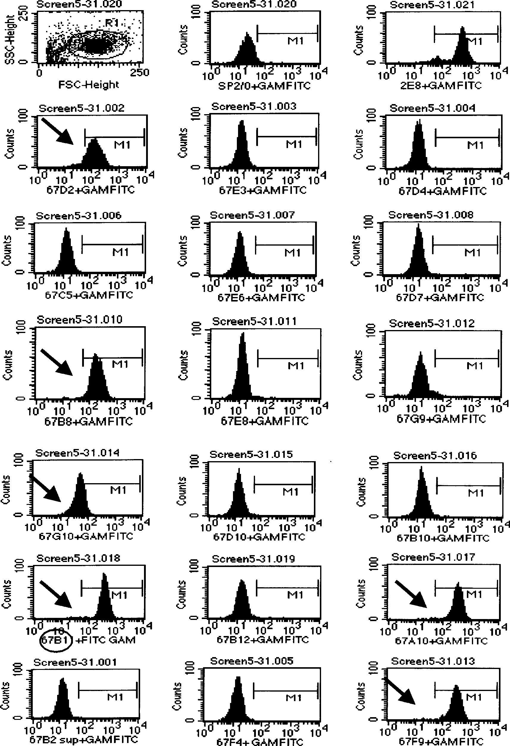 Anti human CD19 mouse immune globulin variable zone gene and uses