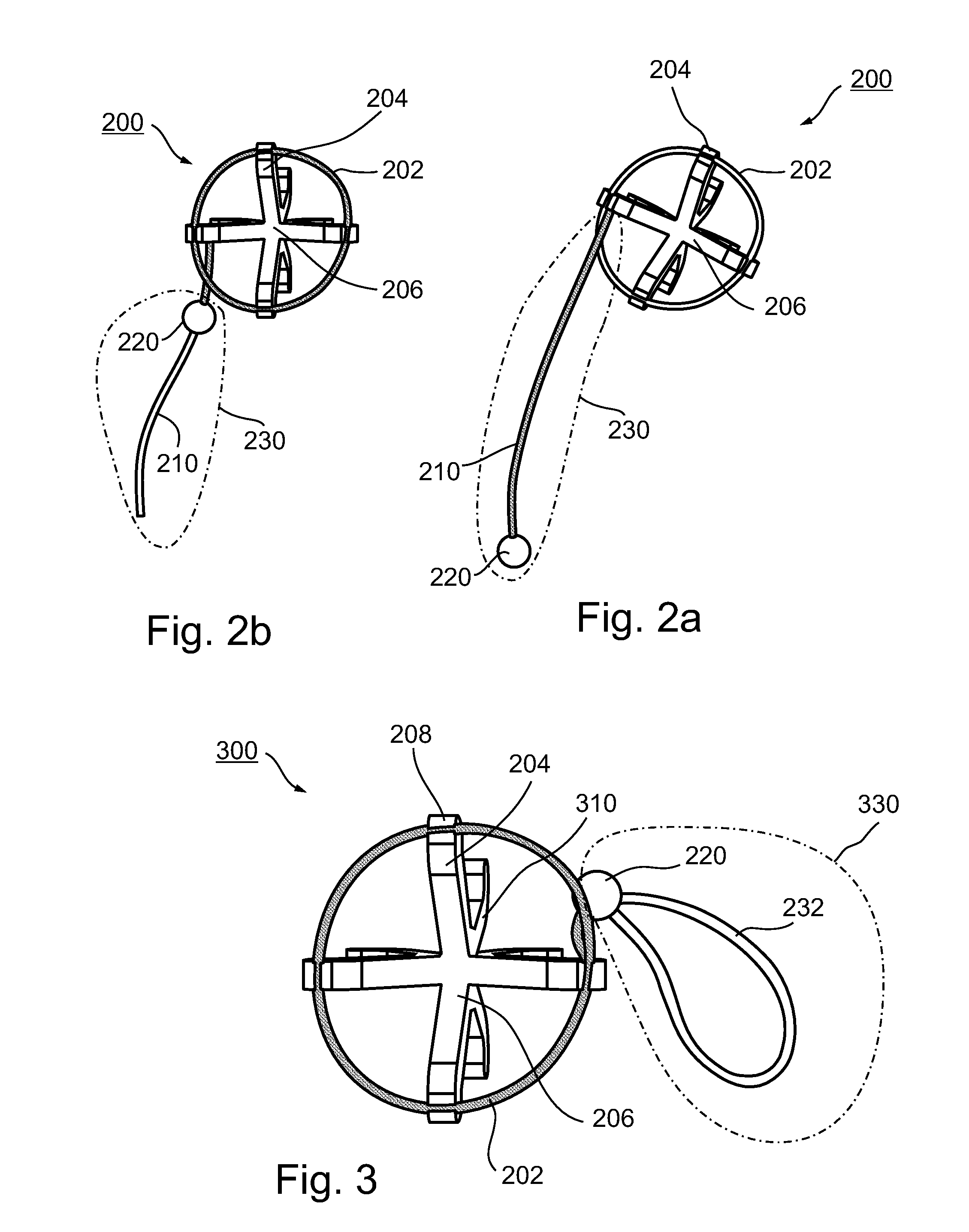 Adjustable tension ring for amelioration of urinary incontinence in females