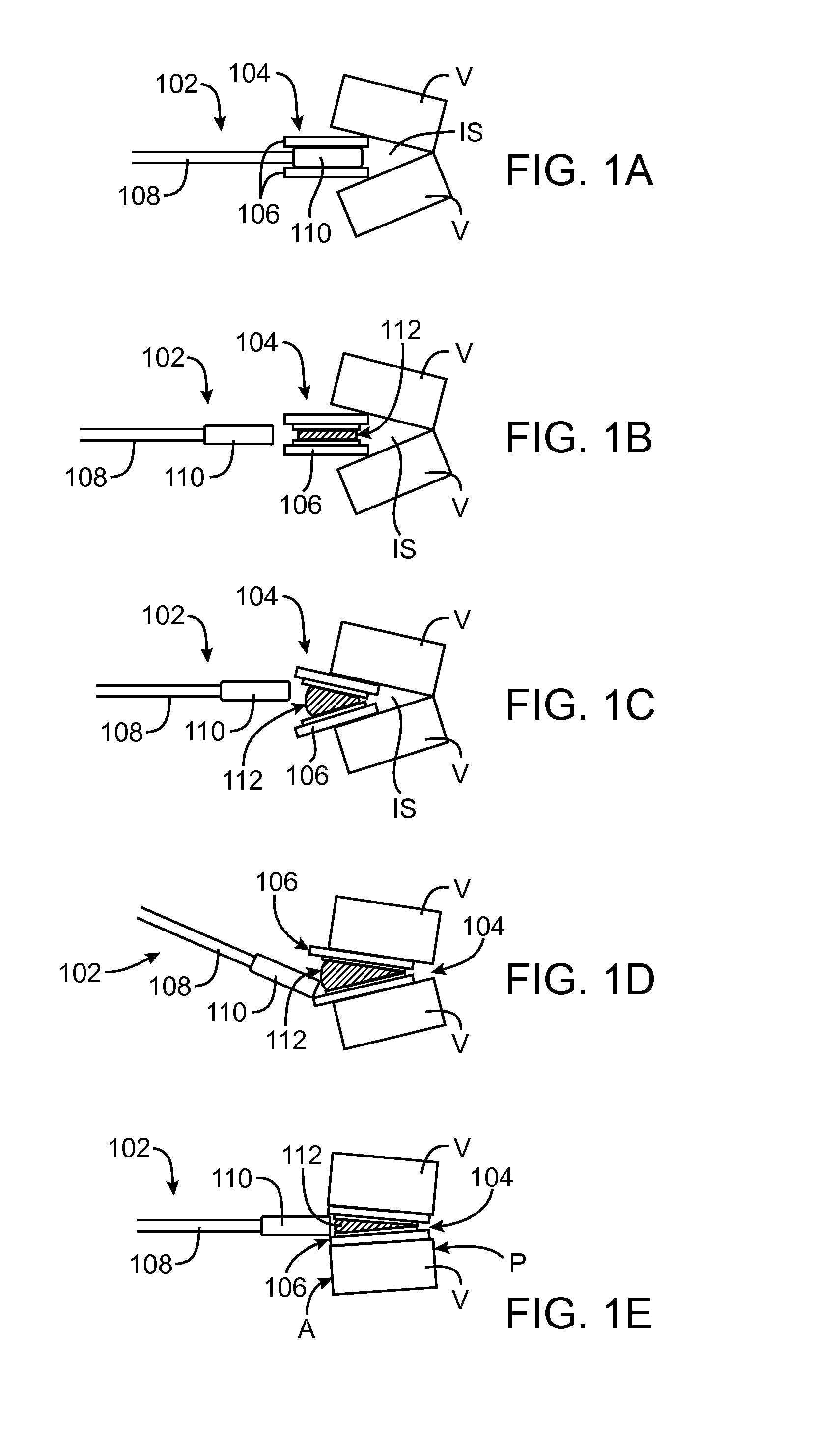 Methods and Apparatus for Intervertebral Disc Prosthesis Insertion