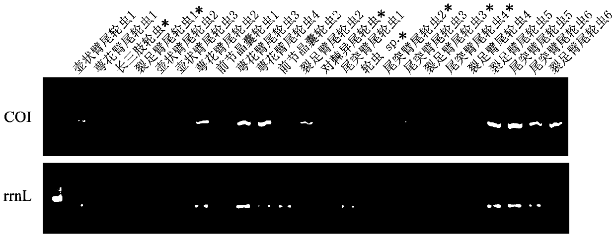 Zooplankton rrnl gene amplification primer and its screening method and application and application method