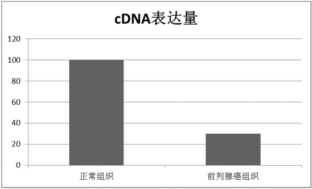 Molecular marker related to prostate cancer and applications of molecular marker