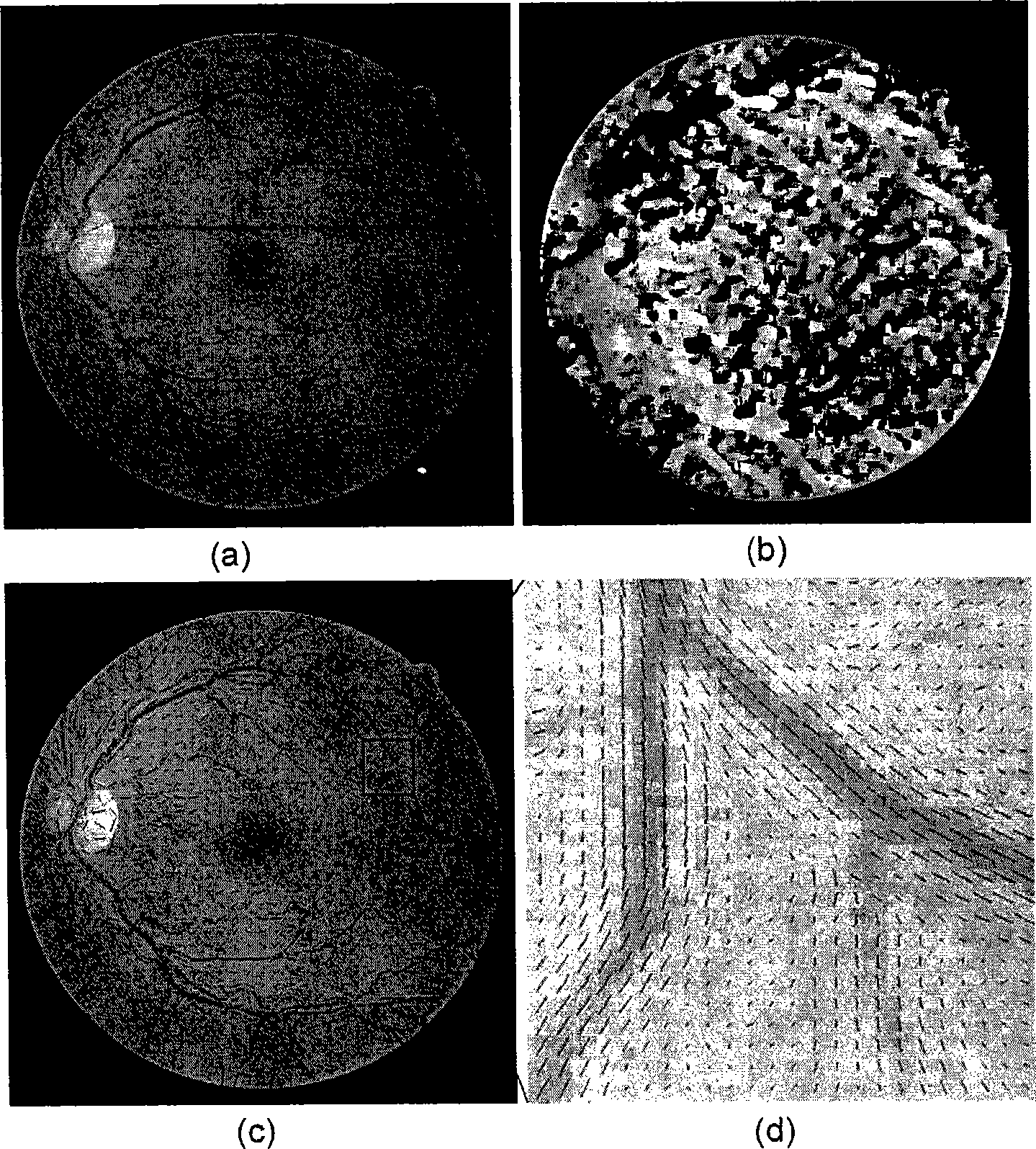 Method for enhancing blood vessels in retinal images based on the directional field