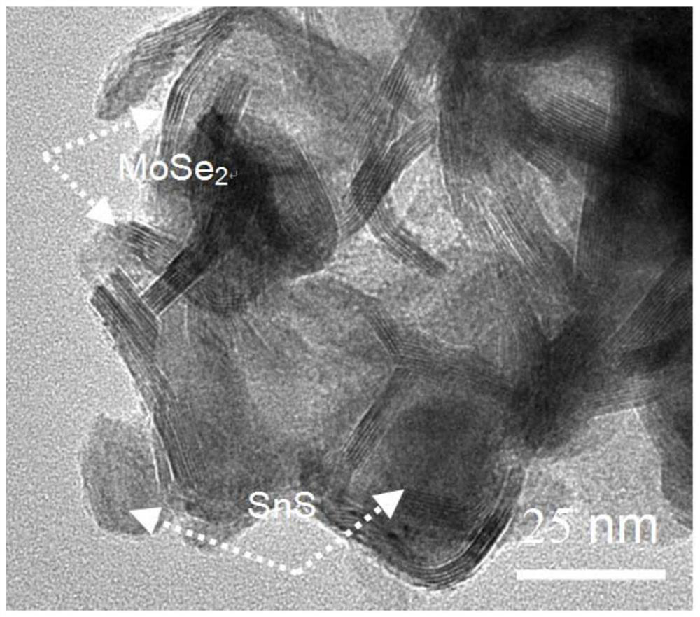 Preparation method and application of graphene@molybdenum diselenide@SnS heterogeneous interface composite material