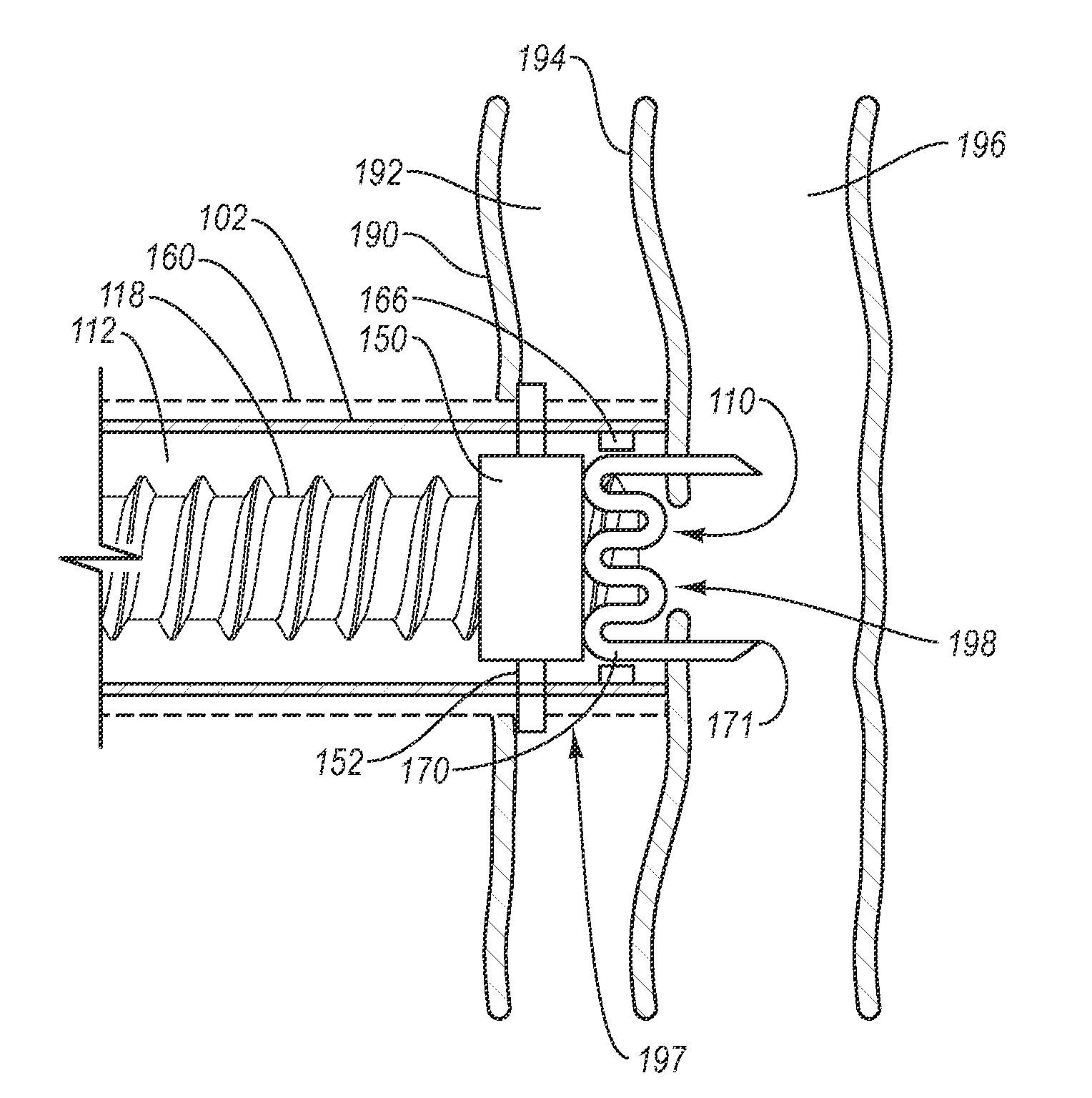 Vessel closure system