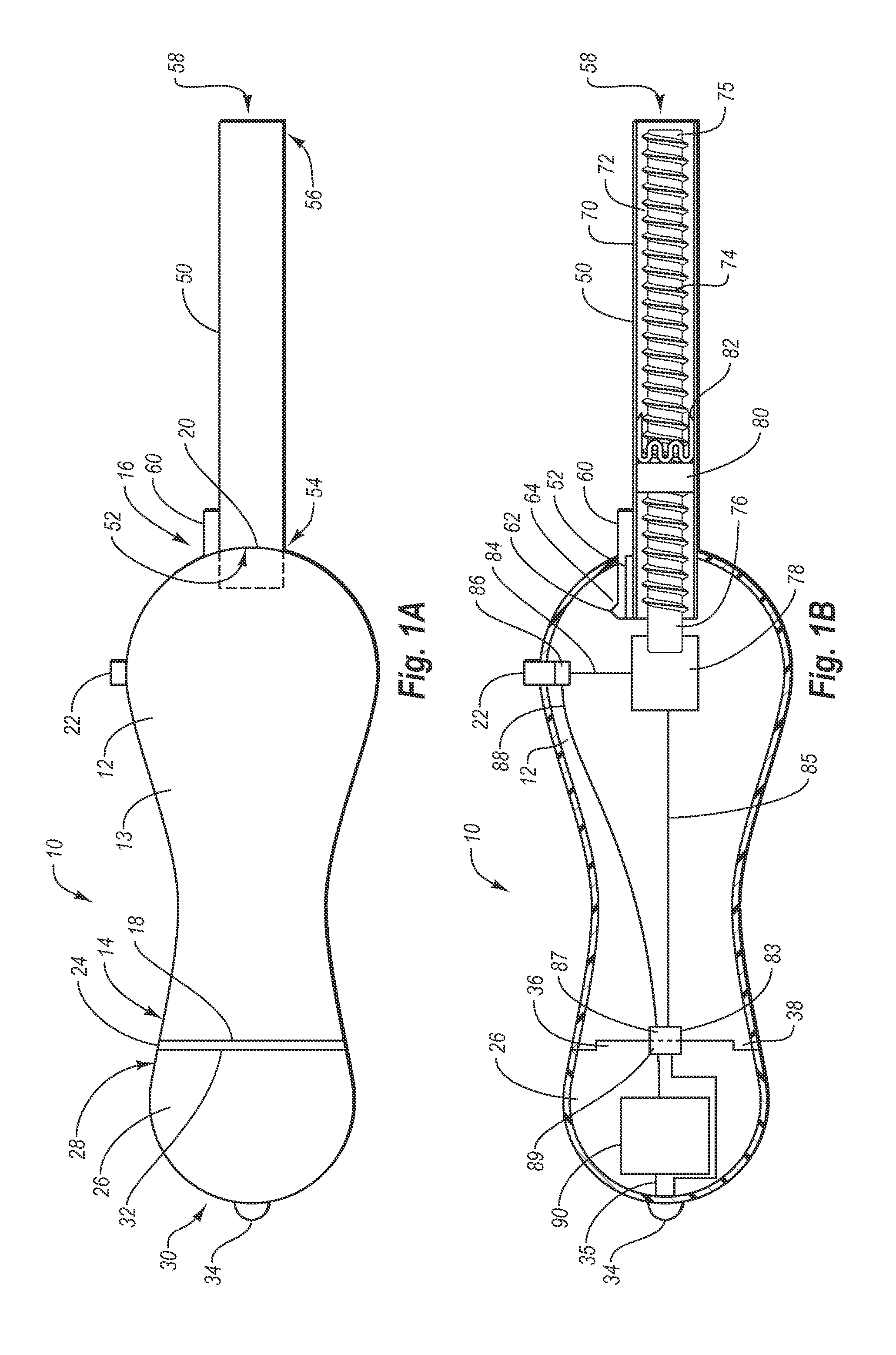 Vessel closure system