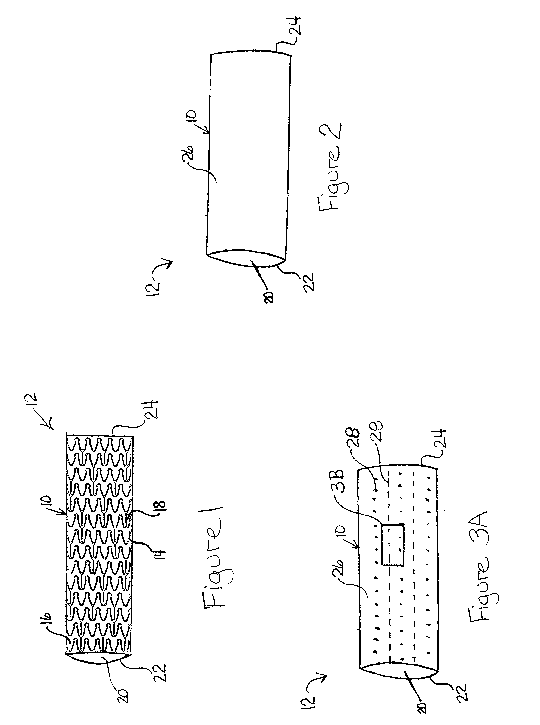 Sheath for a prosthesis and methods of forming the same
