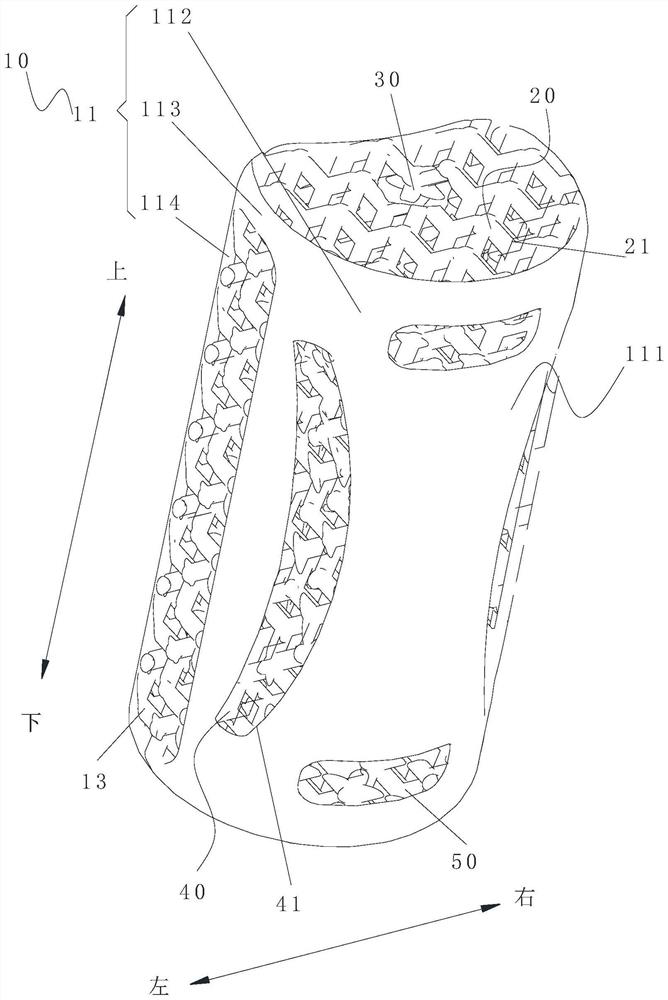 Cervical vertebra prosthesis