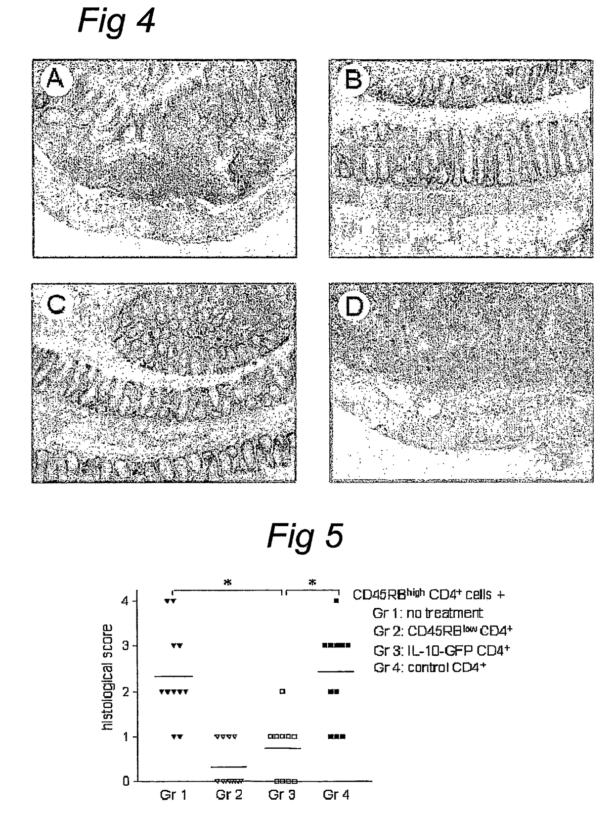 IL-10 gene transfer to peripheral mononuclear cells