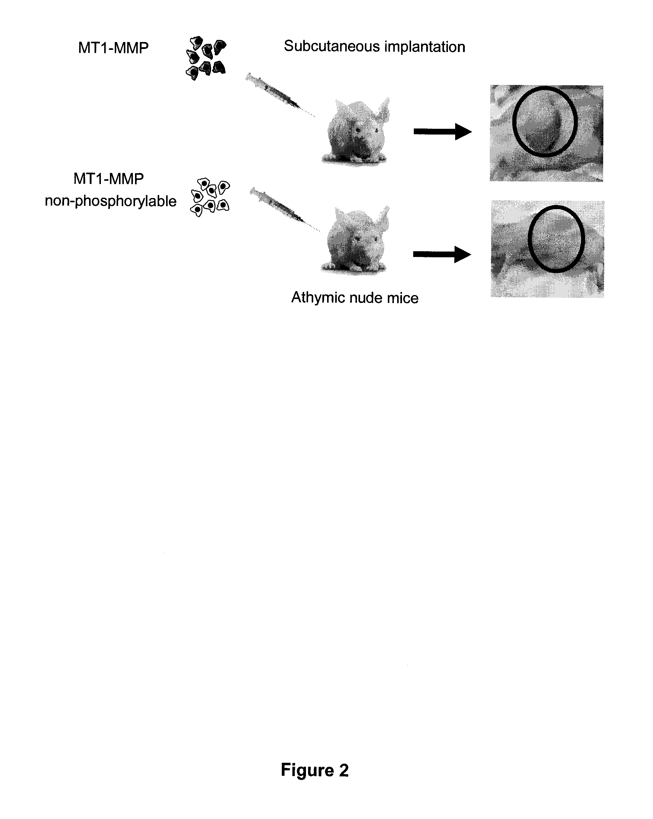 Membrane type-1 matrix metalloprotein inhibitors and uses thereof