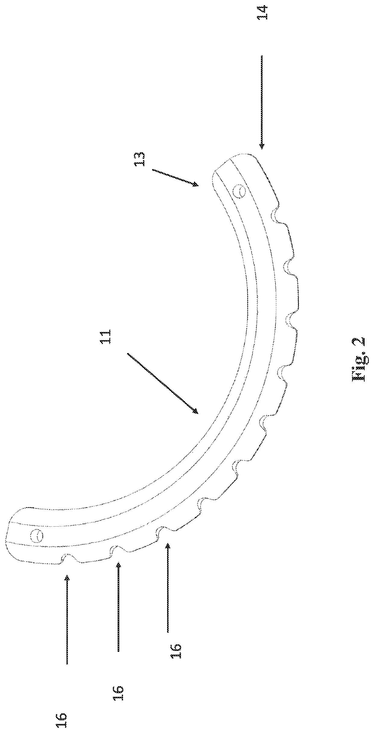 Intracorneal implant and injector to treat corneal disorders