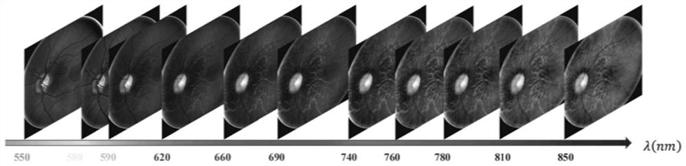 A method and system for fundus image registration based on multispectral