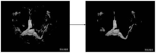 Four-dimensional contrast image generation method, device, equipment and storage medium