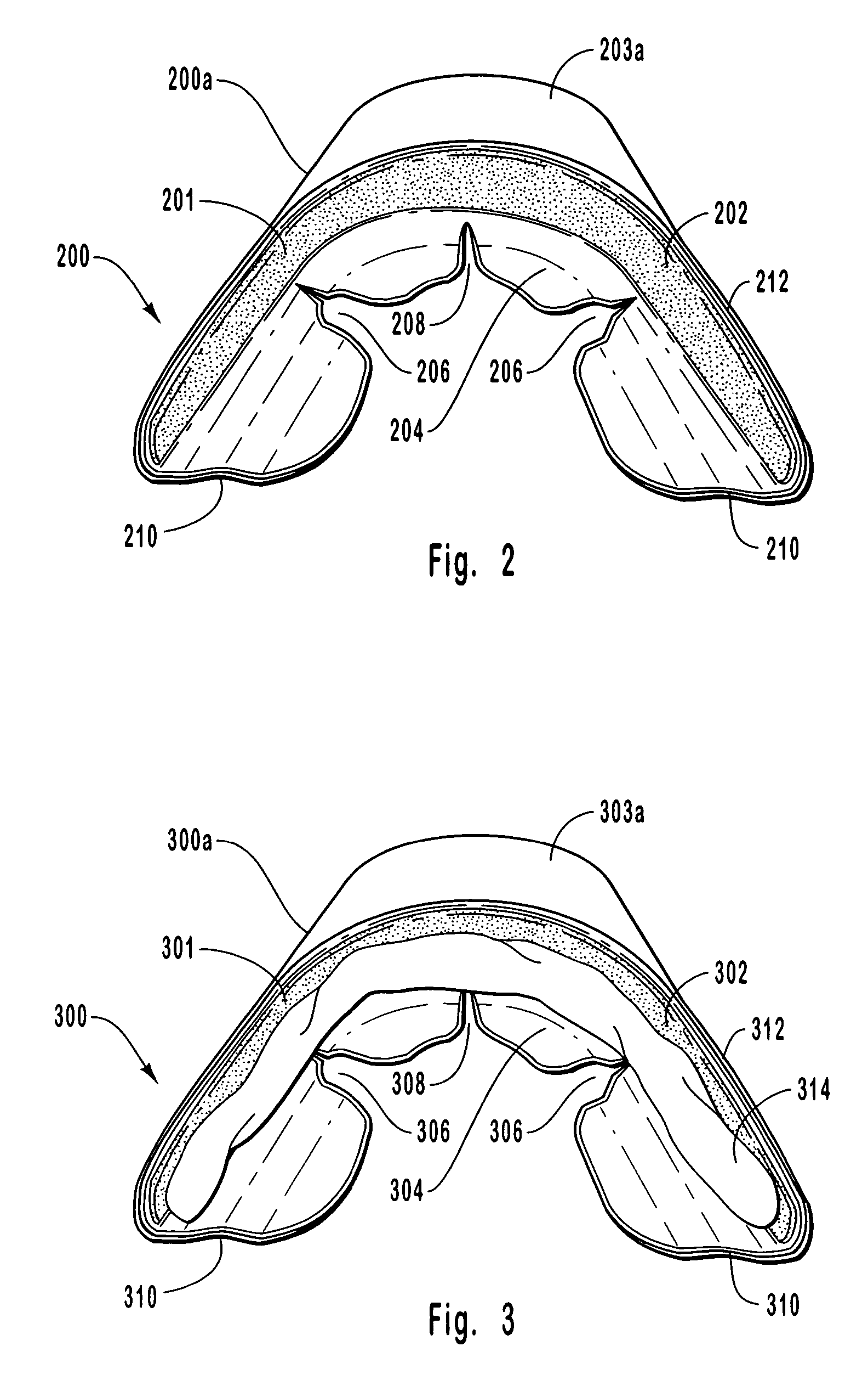 Universal non-custom dental tray having anatomical features to enhance fit