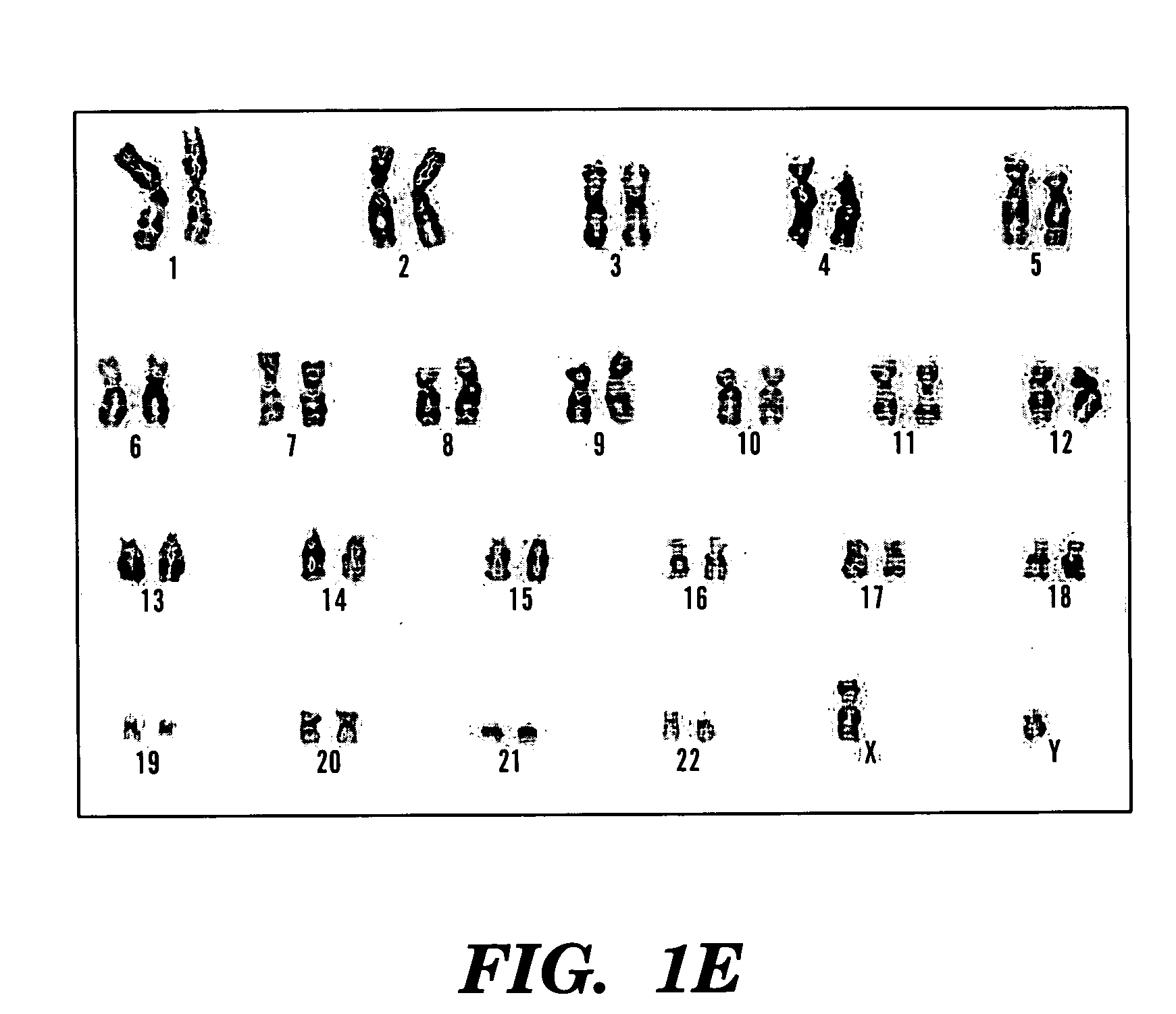 Methods of isolation, expansion and differentiation of fetal stem cells from chorionic villus, amniotic fluid, and placenta and therapeutic uses thereof