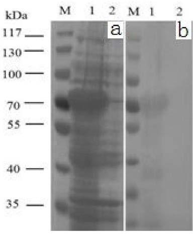 Recombinant plasmid expressing soluble human papillomavirus 16 subtype l1 protein and its expression method