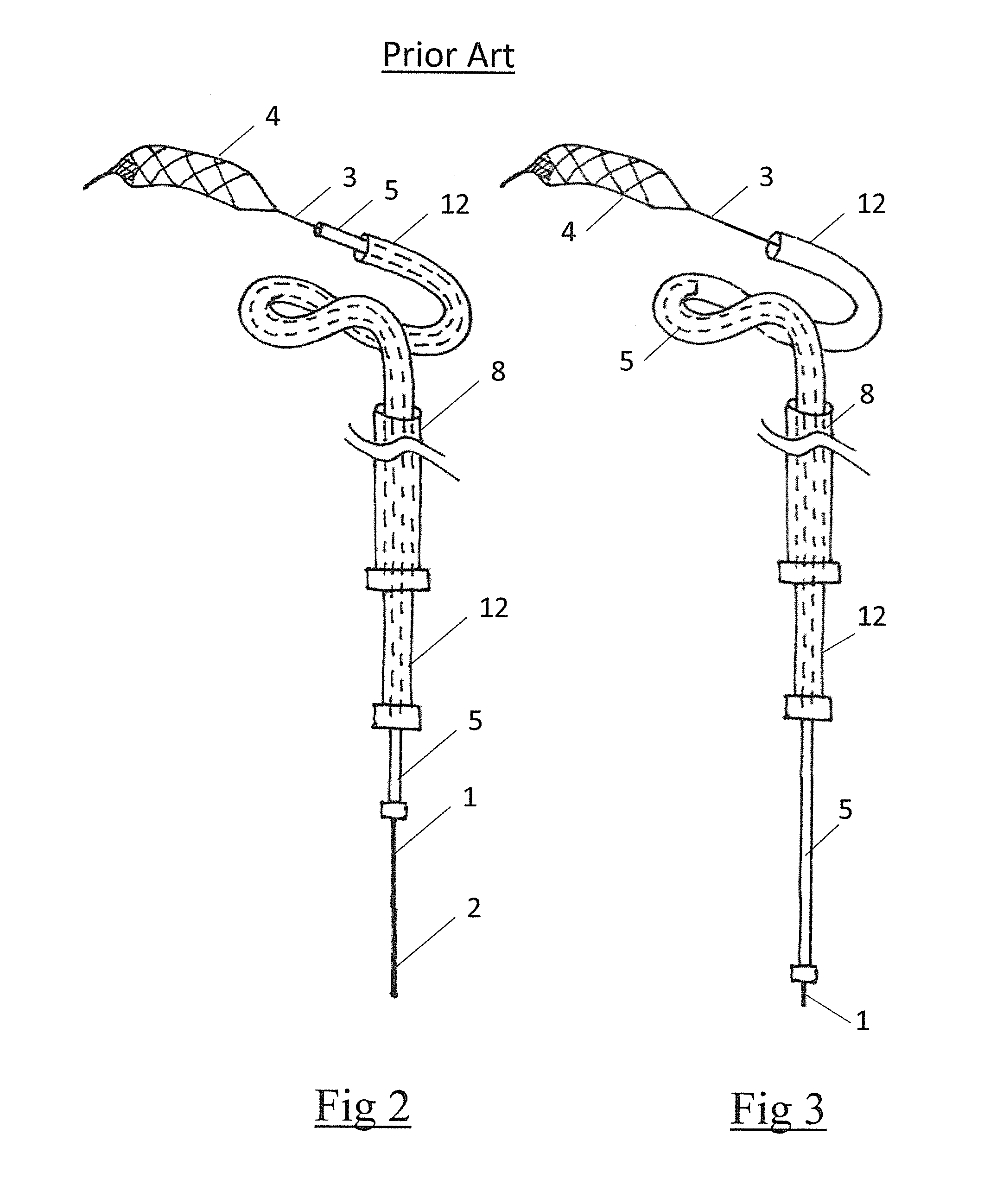 Clot retrieval system for removing occlusive clot from a blood vessel