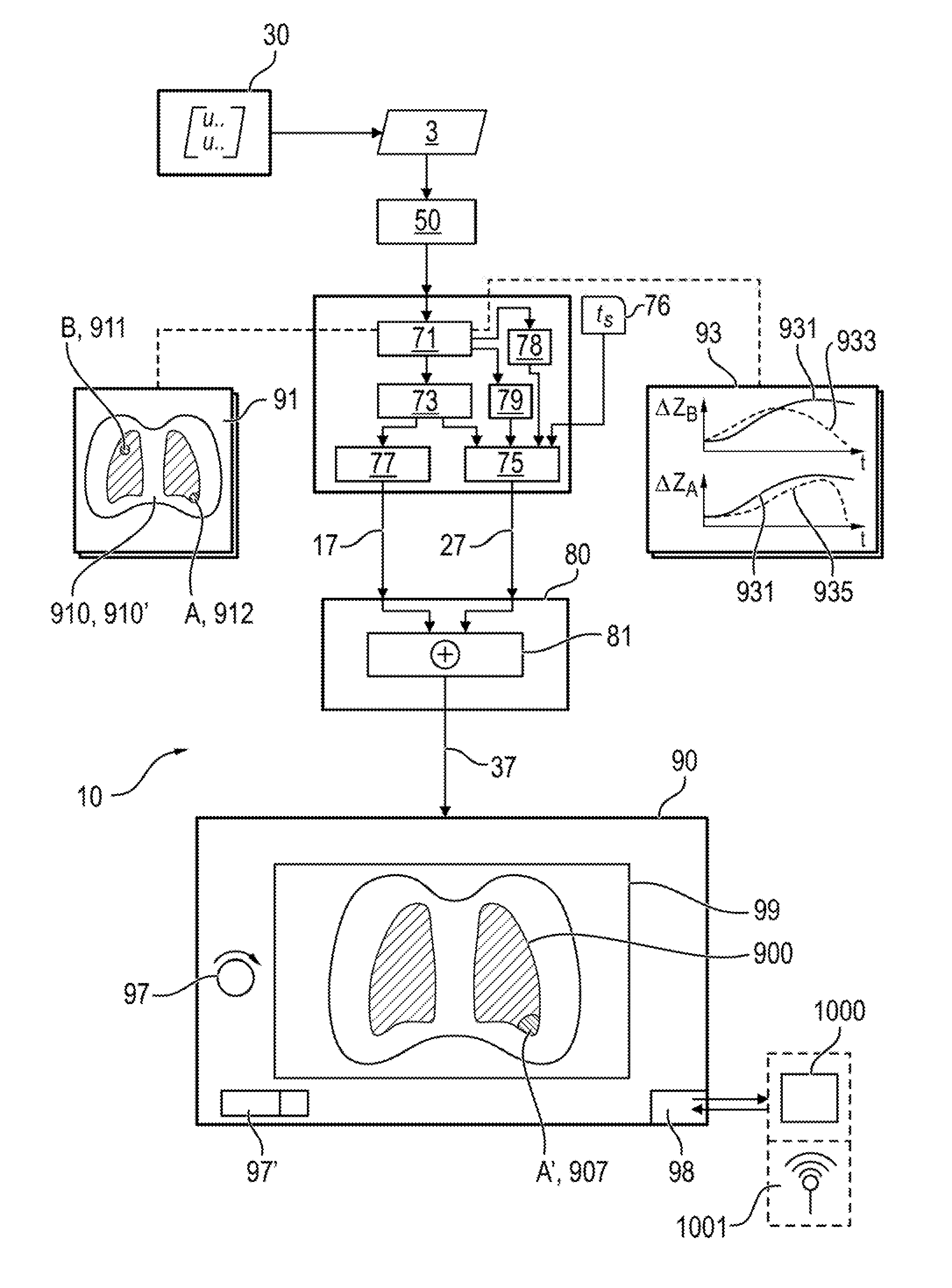 Device for processing and visualizing data of an electric impedance tomography apparatus for determining and visualizing regional ventilation delays in the lungs