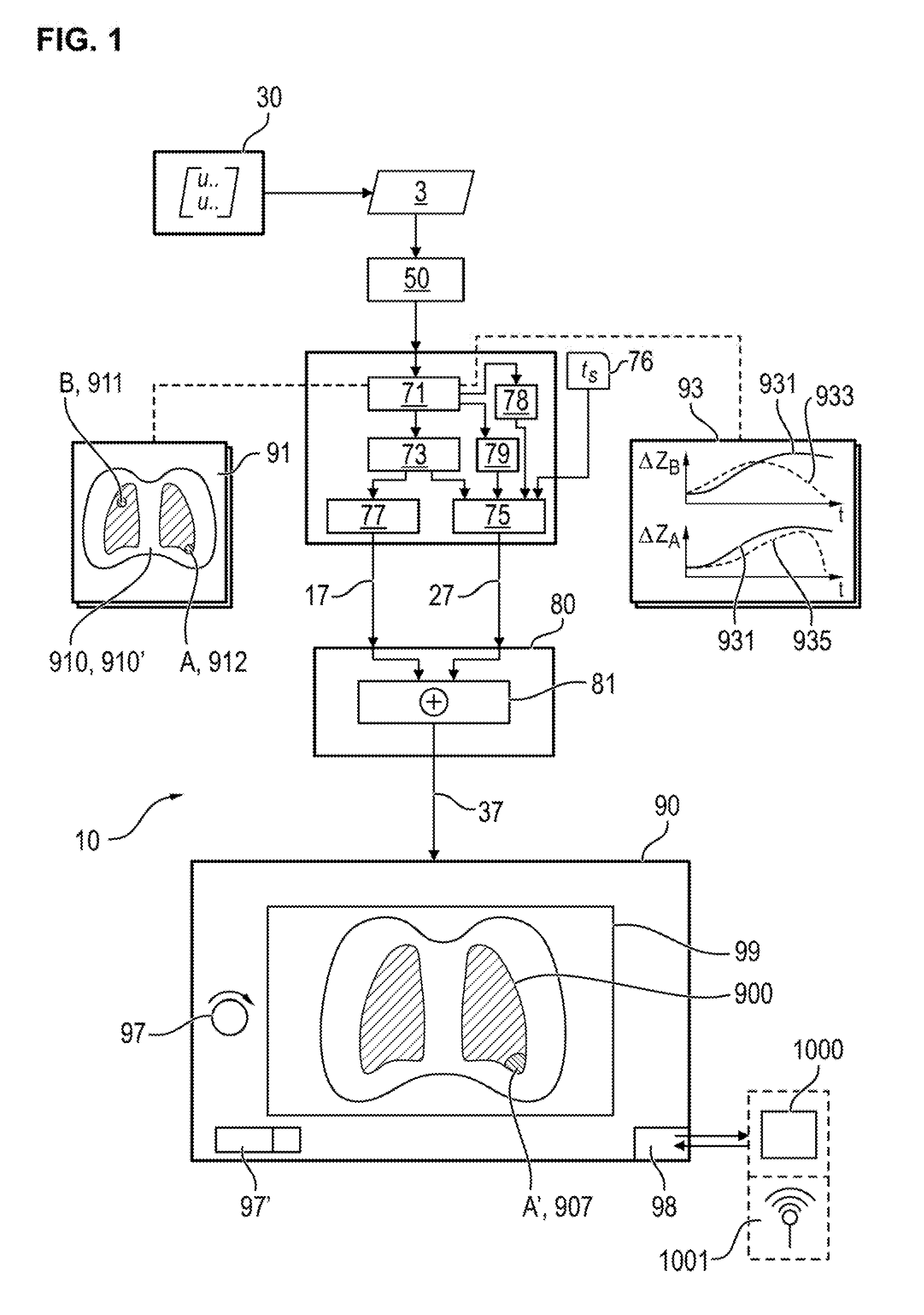Device for processing and visualizing data of an electric impedance tomography apparatus for determining and visualizing regional ventilation delays in the lungs