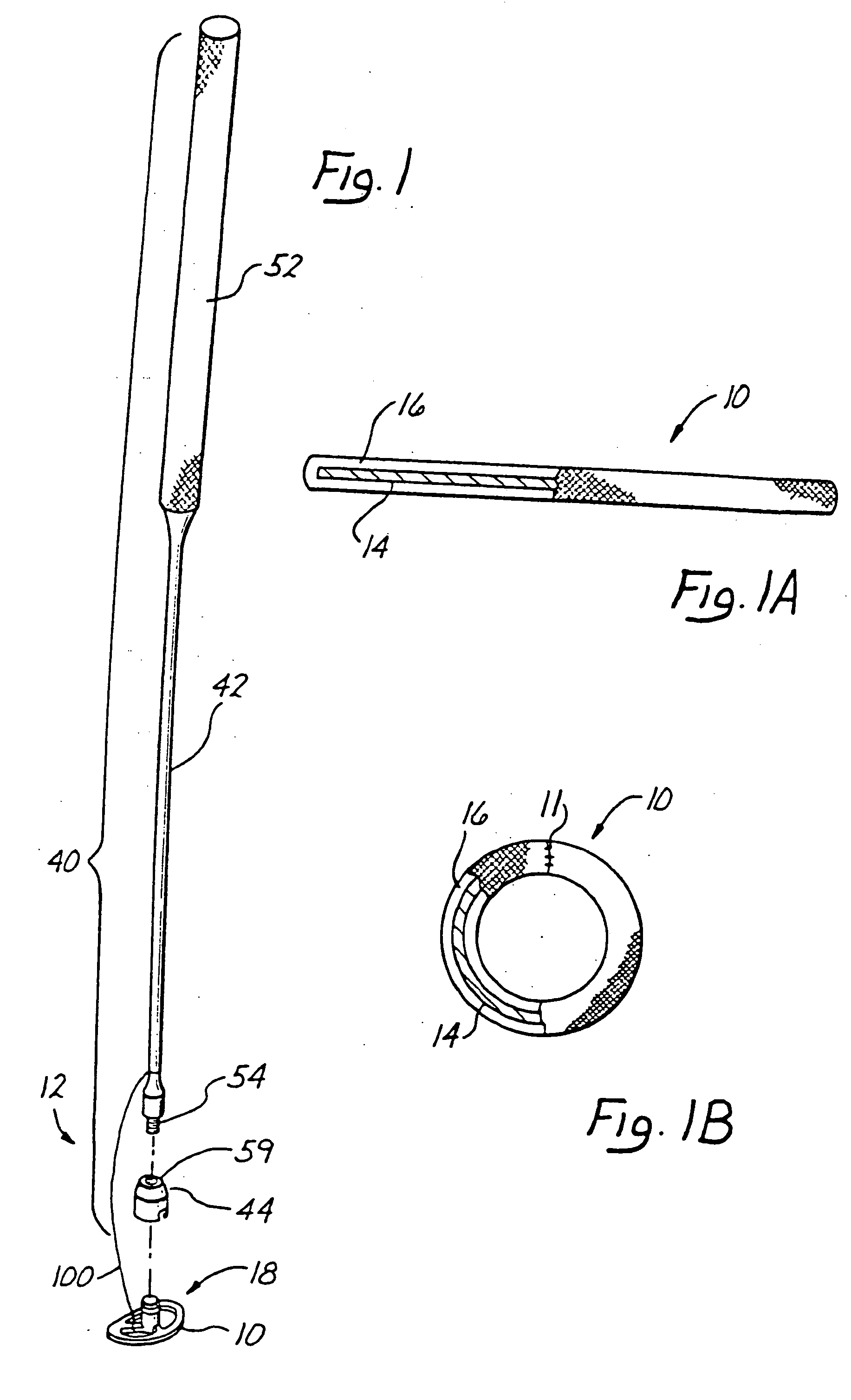 Annuloplasty ring delivery system and method