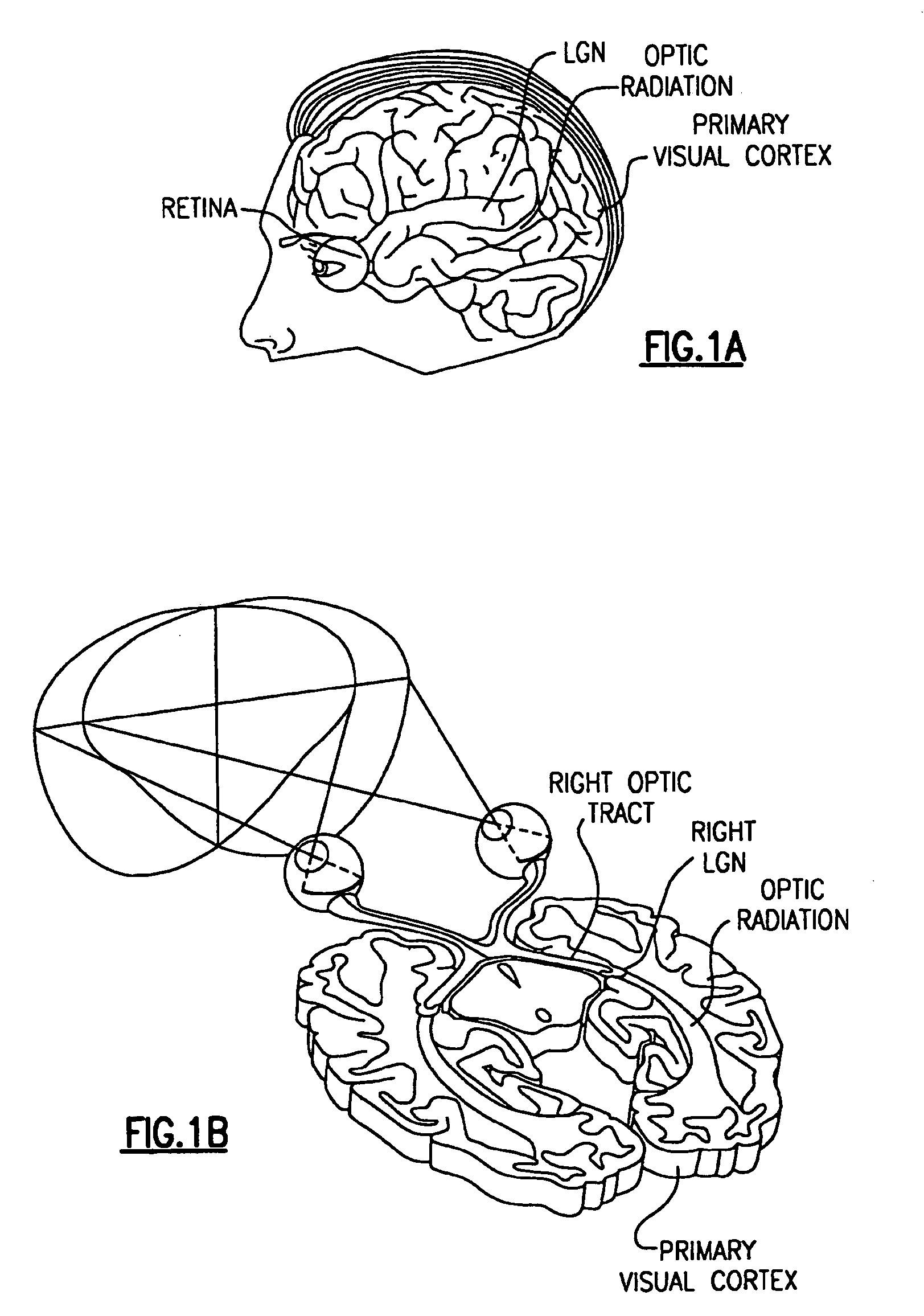 Apparatus and method of diagnosis of optically identifiable ophthalmic conditions