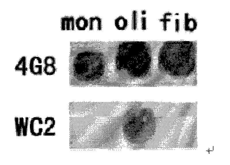 Genetically engineered monoclonal antibody specifically binding to a-beta oligomer