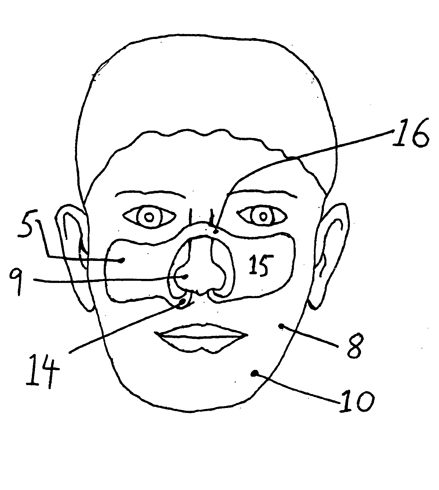 Continuous nasal irrigation device