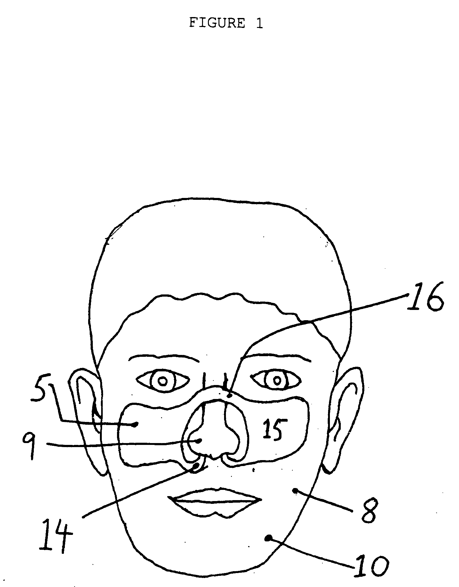 Continuous nasal irrigation device