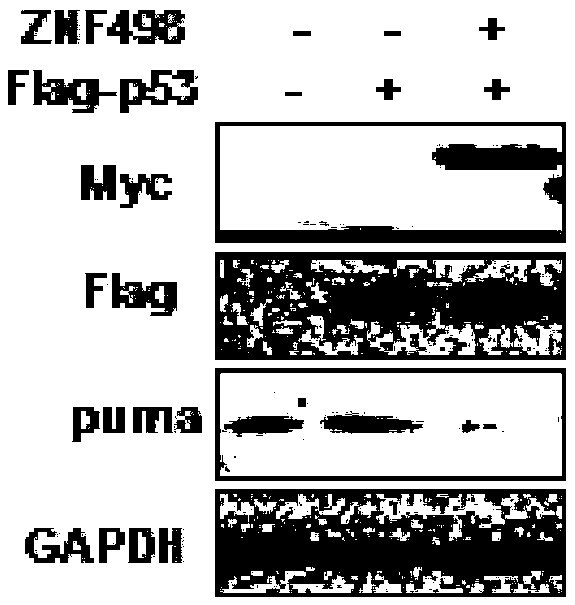 Application of ZNF498 protein expression quantity inhibiting substance in preparing cancer preventing and treating products