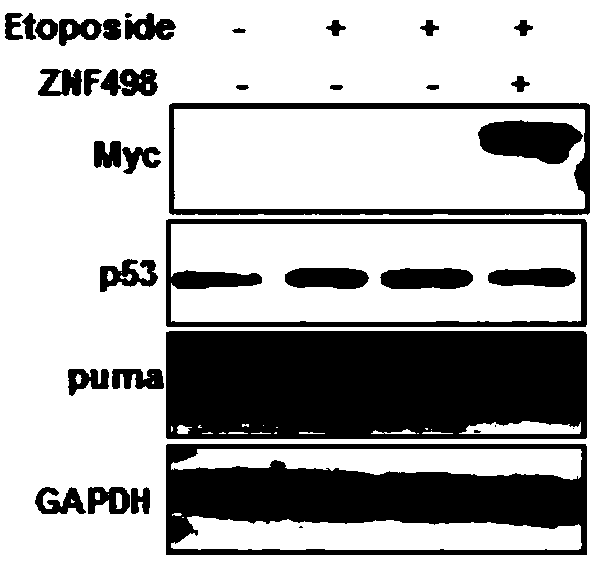 Application of ZNF498 protein expression quantity inhibiting substance in preparing cancer preventing and treating products