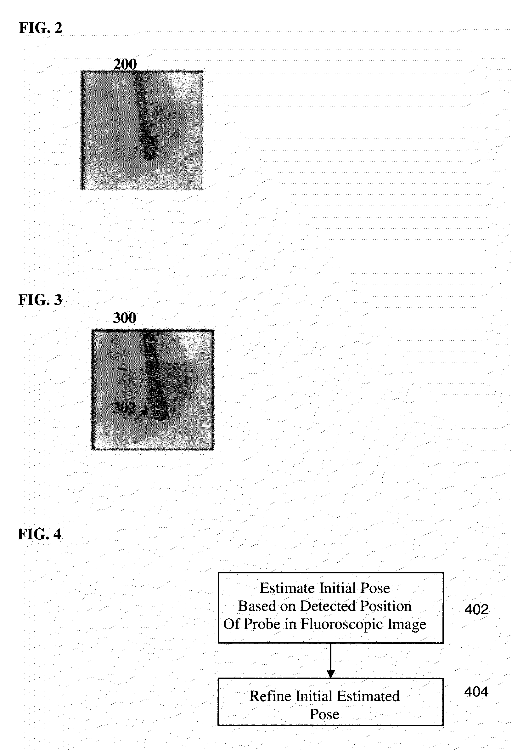 Method and System for Registration of Ultrasound and Physiological Models to X-ray Fluoroscopic Images