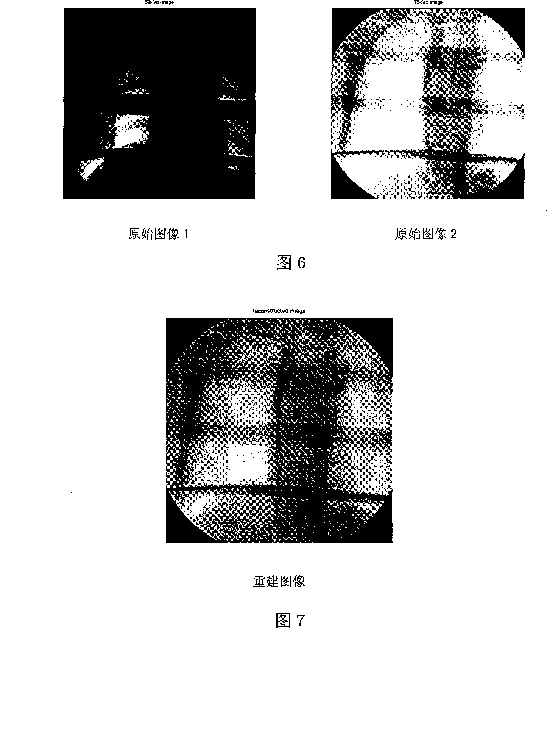 High dynamic range regenerating method of X-ray image based on scale space decomposition