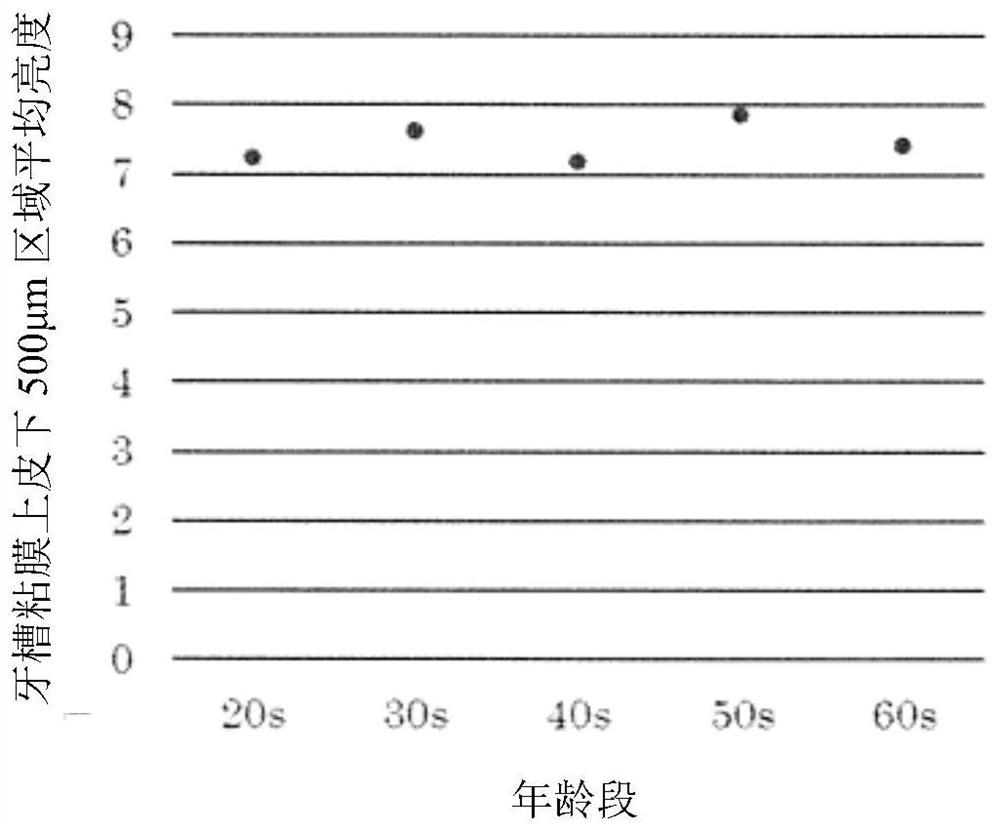 Inspection method for determining oral cavity index