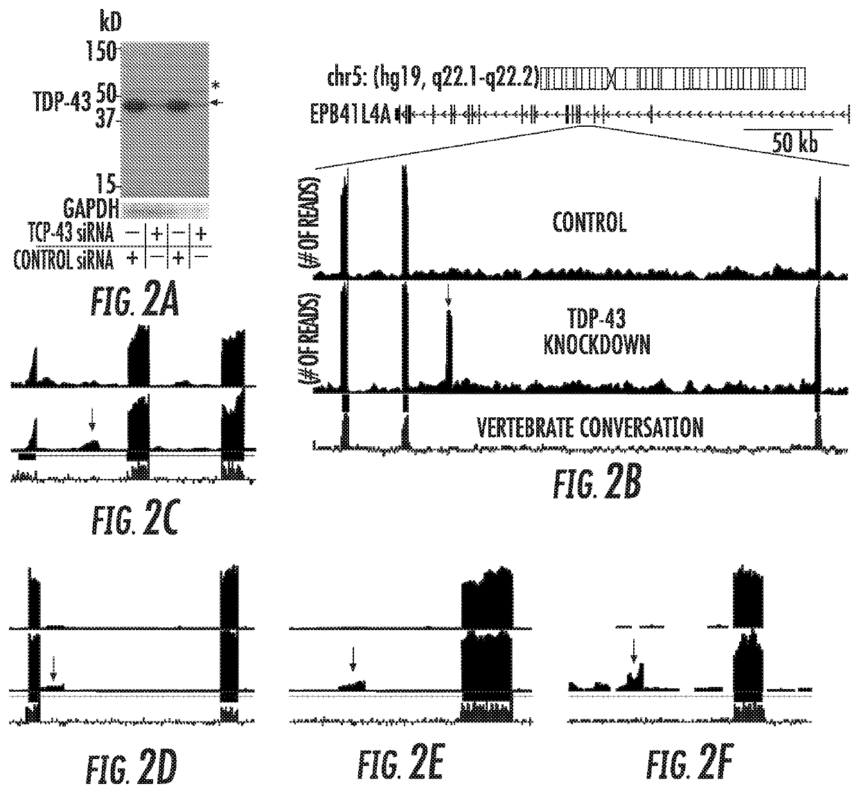 TDP-43 in degenerative disease