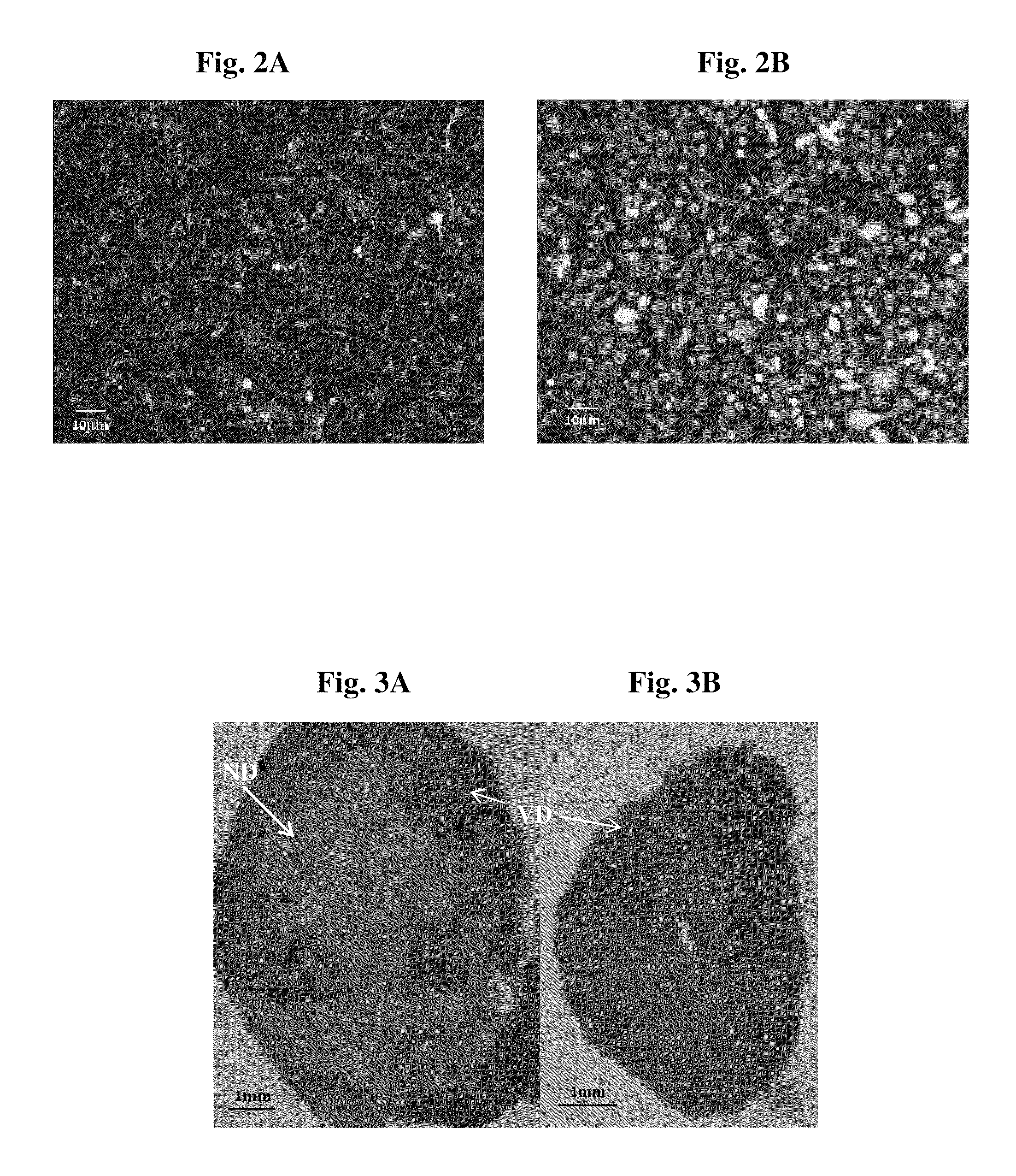 RGD-(bacterio)chlorophyll conjugates for photodynamic therapy and Imaging of Necrotic tumors