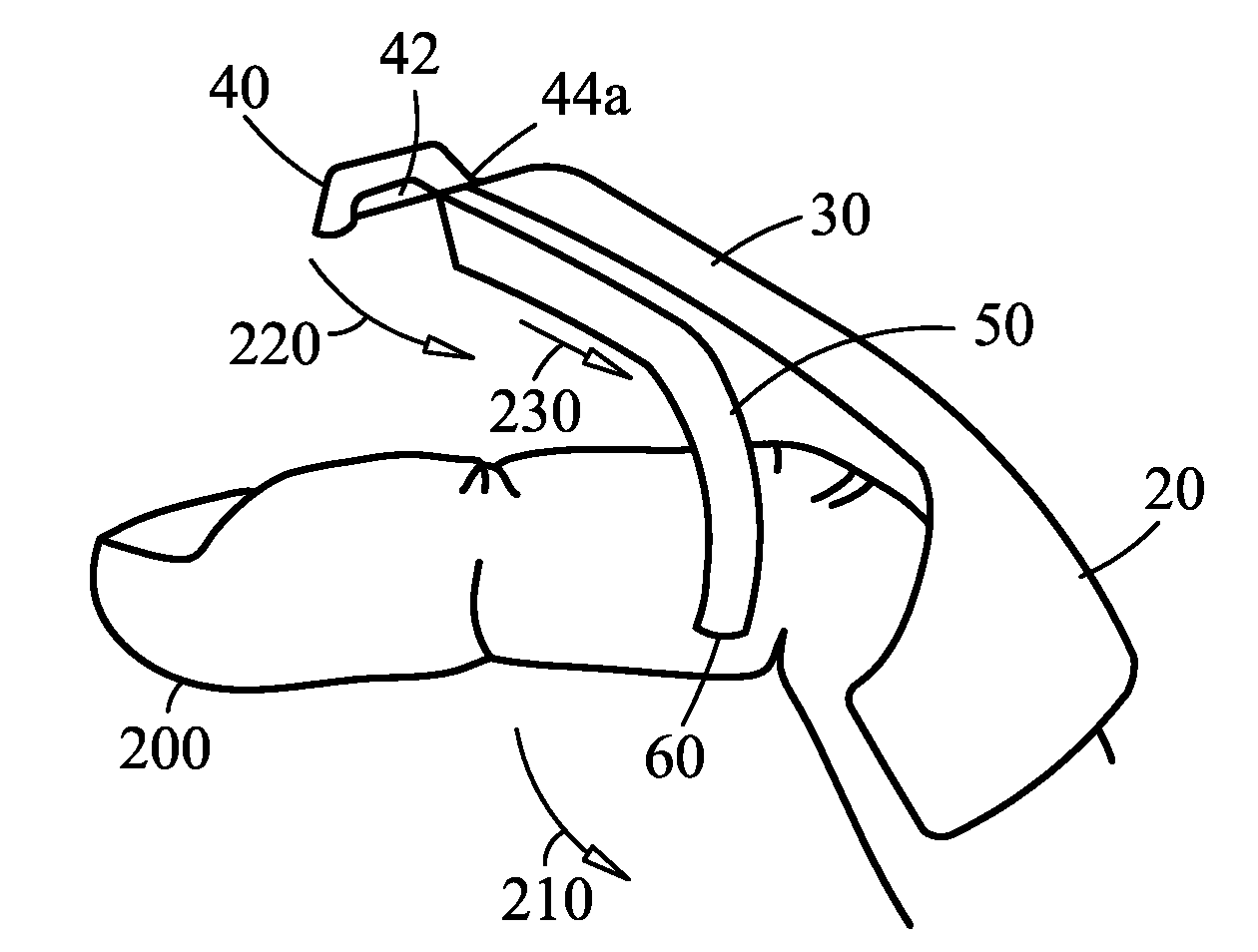 Finger-mounted suture cutter