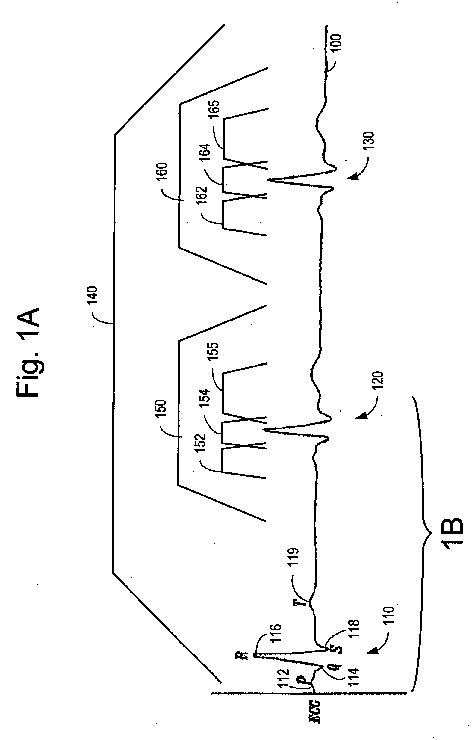 Closed loop cardiac resynchronization therapy using cardiac activation sequence information