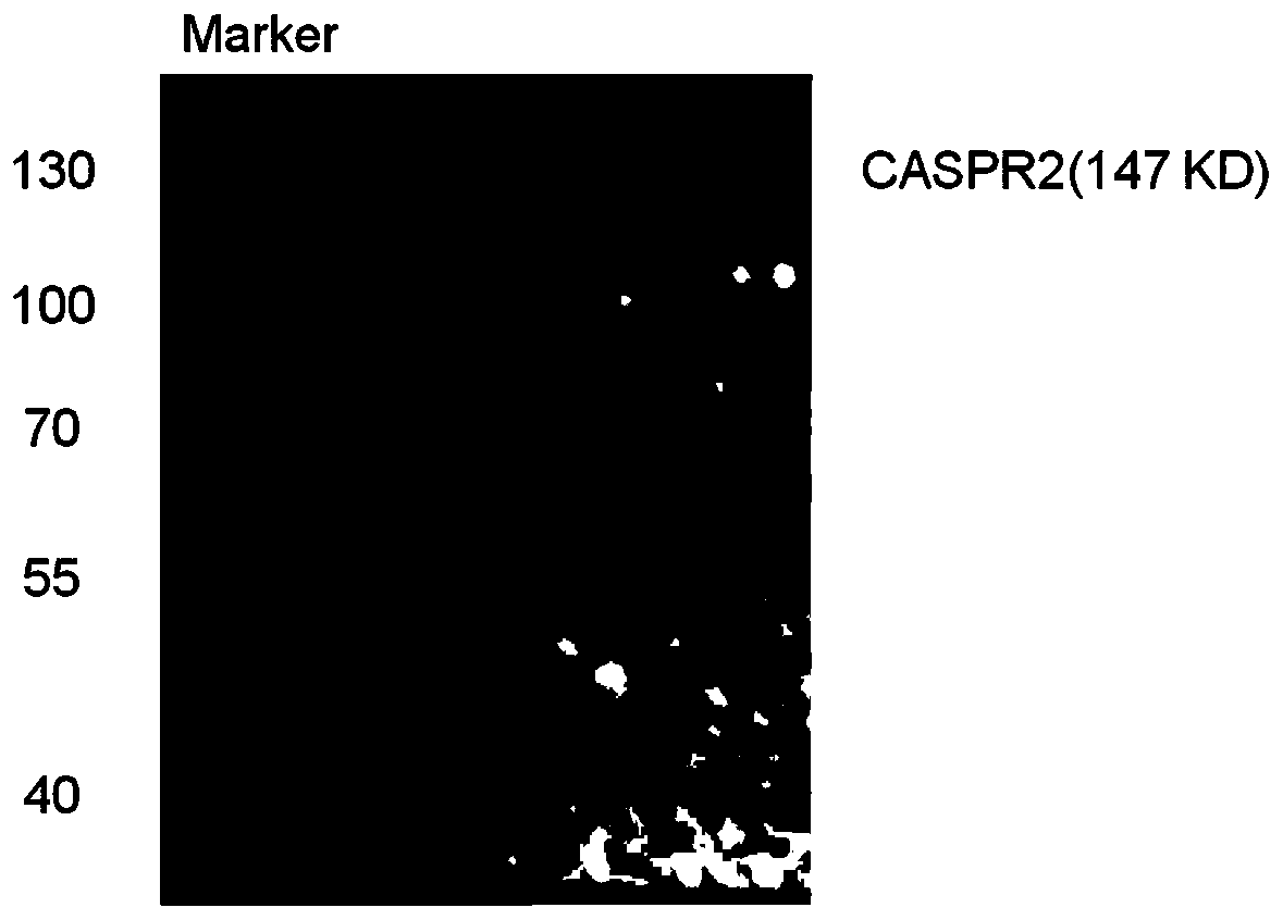 Detection material for resisting CASPR2 autoantibodies in human body fluid, preparation method and application