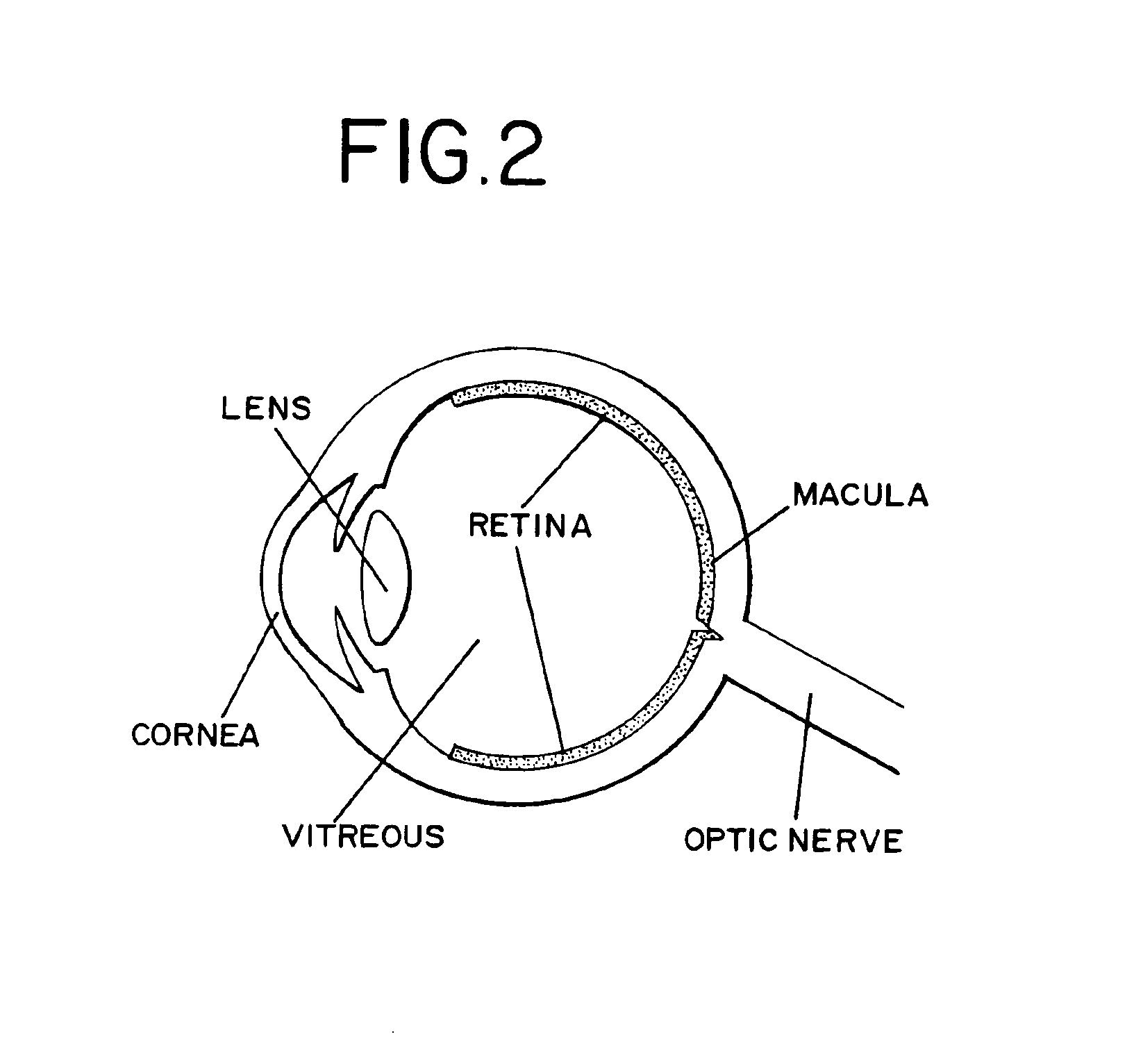 Method of radiation delivery to the eye