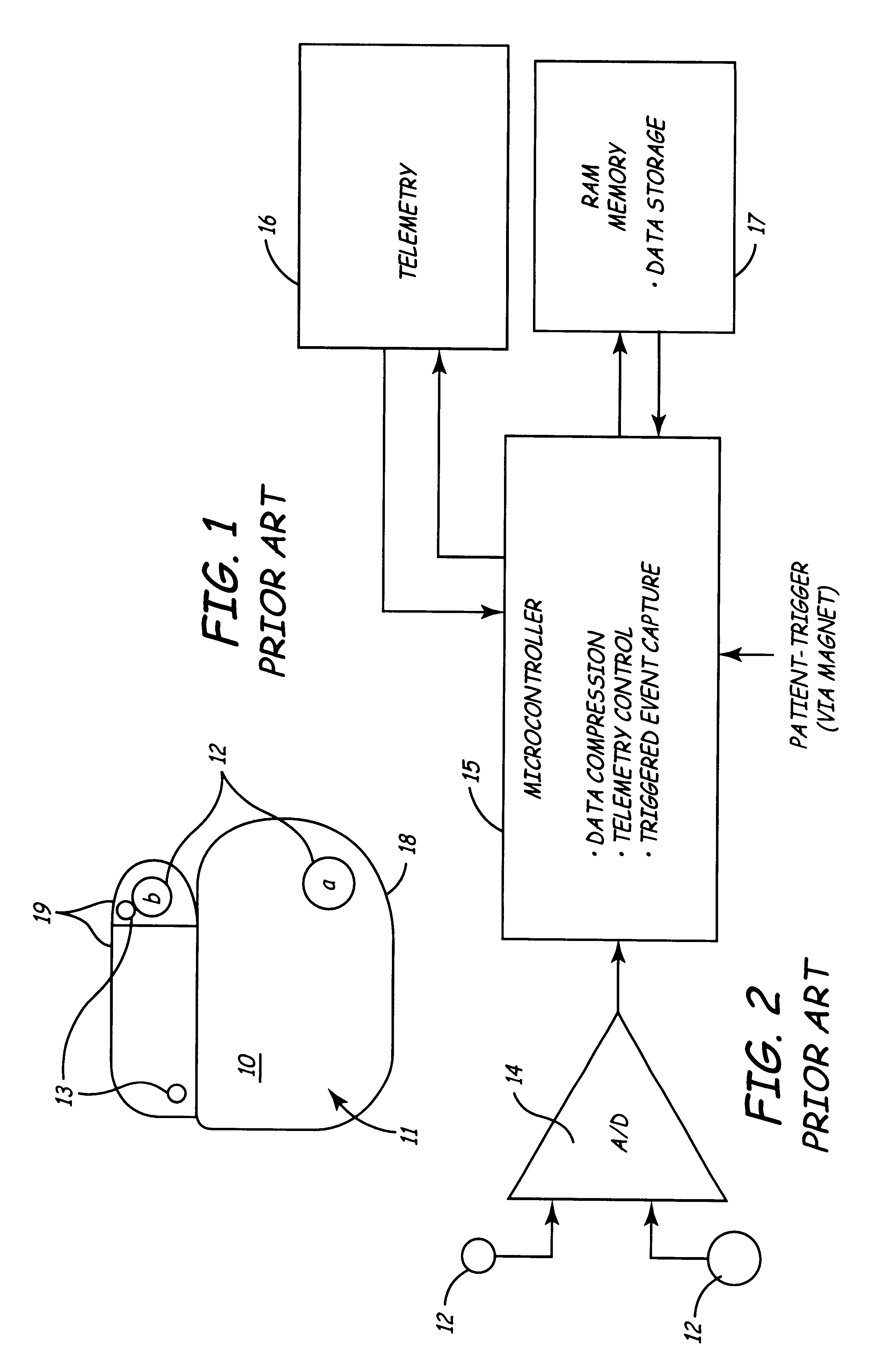 System and method for non-invasive determination of optimal orientation of an implantable sensing device