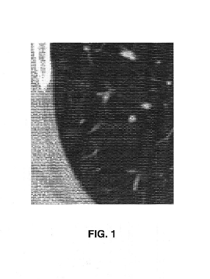 Vessel segmentation with nodule detection