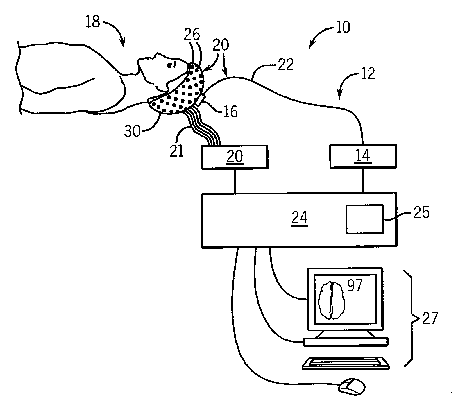 Method for assessing anesthetization